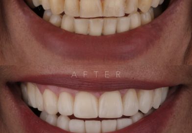 Comunicado Oficial de DENTAL CLONE: Advertencia sobre Suplantación de Identidad y Sitio Web Falso ‘dentalclonevictimas’». Comunicado Oficial de DENTAL CLONE: Advertencia sobre Suplantación de Identidad y Sitio Web Falso ‘dentalclonevictimas’».